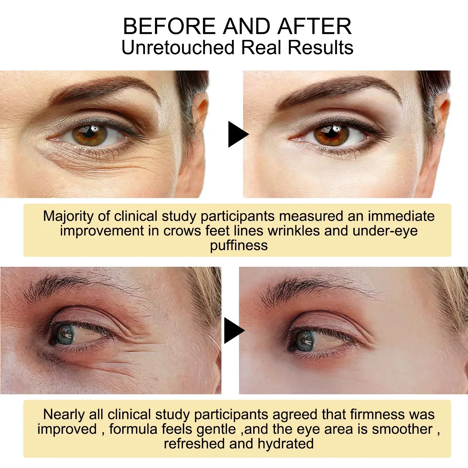 Neue 7-Tage-Faltenstraffung Au – Oligopeptide Wrinkle Bewertung und Preis